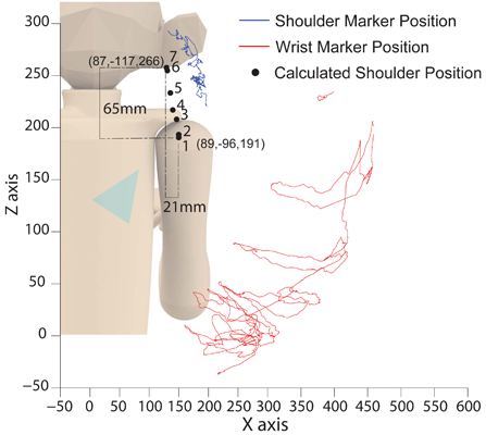 shoulder elevation